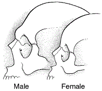 FTM/MTFの男女の骨格の違い